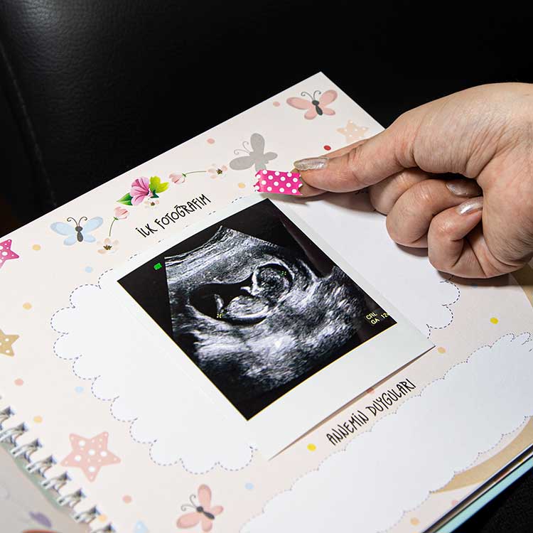Hamilelik ve Bebek Anı Defteri | Spiralli, Kutulu 9 Ay + 1 Yıl Günlüğü